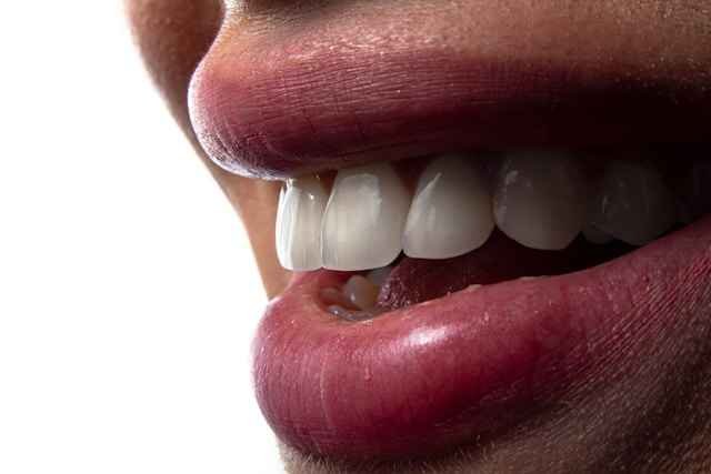 Beyond Aesthetics: How Crowded Teeth Affect Oral Health